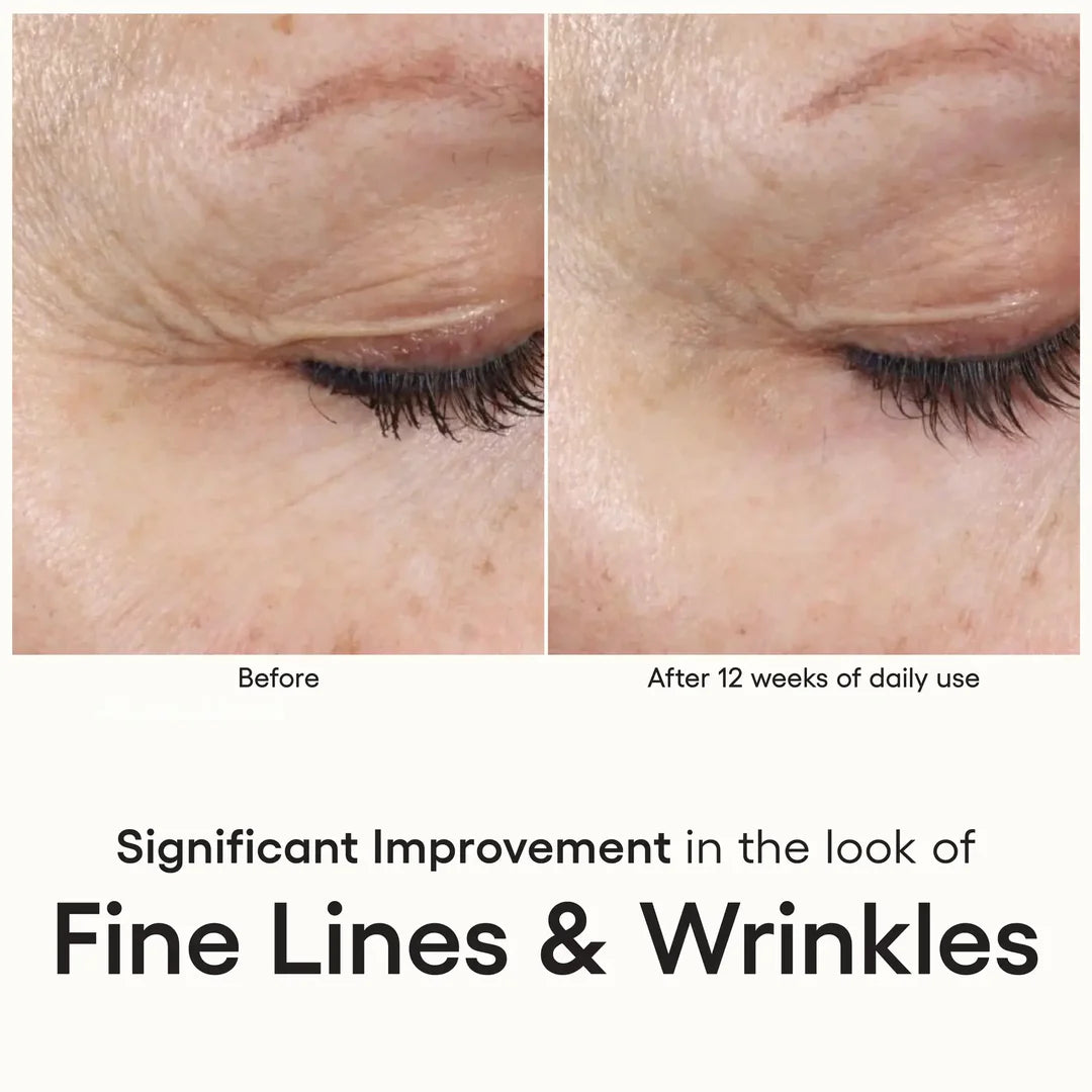 (Plated) INTENSE serum