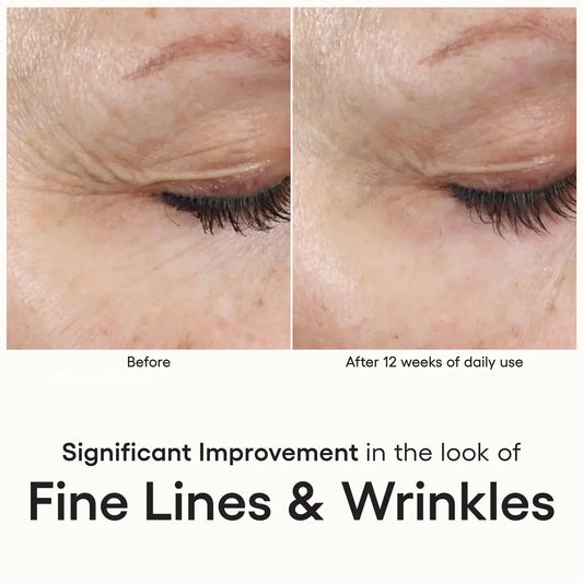 (Plated) INTENSE serum